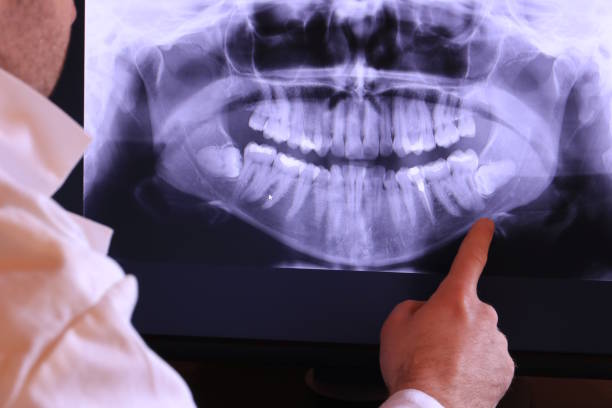 Best Orthodontic Emergency Dentist in Connell, WA