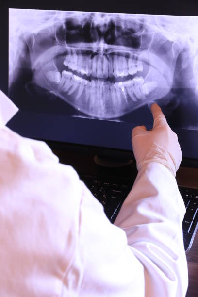 Best Emergency Dental Services for Seniors in Connell, WA