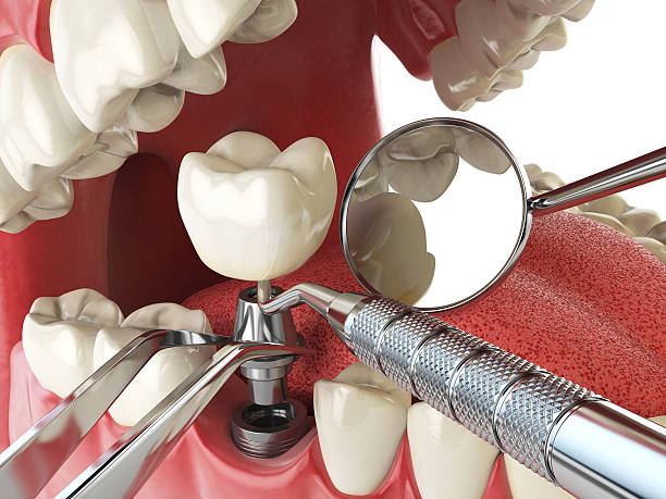 Best 24-Hour Emergency Dentist in Connell, WA